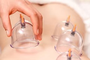 Therapist performing dynamic cupping massage with silicone cups on a client’s back